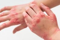 Kesan Positif Skincare Bebas Alkohol: Cara Menjaga Kulit yang Seimbang dan Sihat