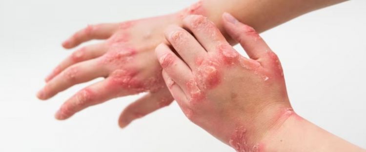 Kesan Positif Skincare Bebas Alkohol: Cara Menjaga Kulit yang Seimbang dan Sihat